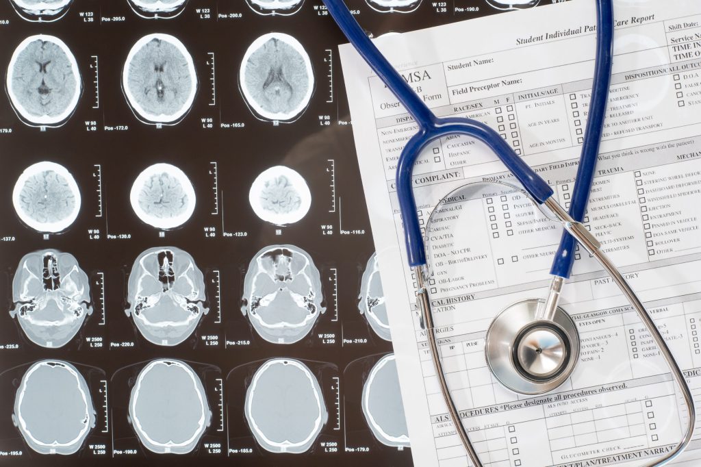 medical-report-and-stethoscope-lying-over-xray-doctor-documentation-SBI-300904615 brain health